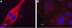 CHRM4 Polyclonal Antibody, Invitrogen 50 &mu;L; Unconjugated:Antibodies,