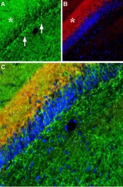 Norepinephrine Transporter (extracellular) Polyclonal Antibody, Invitrogen