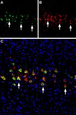 CHRNA4 (extracellular) Polyclonal Antibody, Invitrogen 50 &mu;L; Unconjugated:Antibodies,