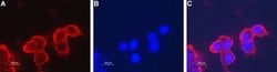 CHRNB4 (extracellular) Polyclonal Antibody, Invitrogen 50 &mu;L; Unconjugated:Antibodies,