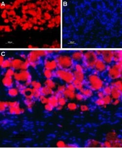 CHRNB4 (extracellular) Polyclonal Antibody, Invitrogen 50 &mu;L; Unconjugated:Antibodies,