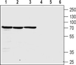 CHRNB4 (extracellular) Polyclonal Antibody, Invitrogen 50 &mu;L; Unconjugated:Antibodies,