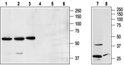 NPY1R Polyclonal Antibody, Invitrogen 50 &mu;L; Unconjugated:Antibodies,