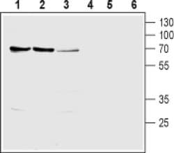 SLC28A1 Polyclonal Antibody, Invitrogen 50 &mu;L; Unconjugated:Antibodies,