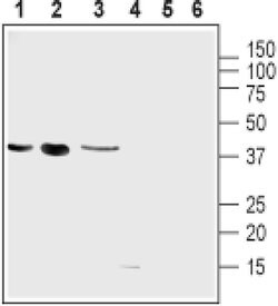 UCP2 Polyclonal Antibody, Invitrogen 50 &mu;L; Unconjugated:Antibodies,