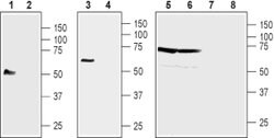 NIPA4 (extracellular) Polyclonal Antibody, Invitrogen 50 &mu;L; Unconjugated:Antibodies,