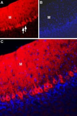 SLC8A2 Polyclonal Antibody, Invitrogen 50 &mu;L; Unconjugated:Antibodies,