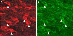 KCNN3 Polyclonal Antibody, Invitrogen 50 &mu;L; Unconjugated:Antibodies,