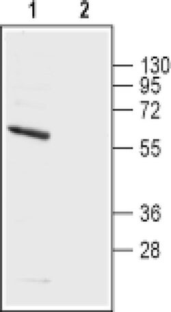 KV1.5 (KCNA5) (extracellular) Polyclonal Antibody, Invitrogen 50 &mu;L;