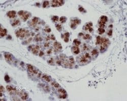 Aquaporin 8 Polyclonal Antibody, Invitrogen 50 &mu;L; Unconjugated:Antibodies,