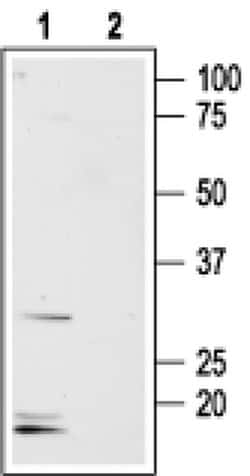 Aquaporin 8 Polyclonal Antibody, Invitrogen 50 &mu;L; Unconjugated:Antibodies,