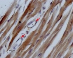 SCN5A Polyclonal Antibody, Invitrogen 50 &mu;L; Unconjugated:Antibodies,