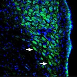 pan ASIC (extracellular) Polyclonal Antibody, Invitrogen 50 &mu;L; Unconjugated:Antibodies,