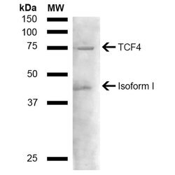 Invitrogen TCF4 Polyclonal Antibody 100 &mu;g; Unconjugated:Antibodies,