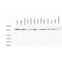 Invitrogen AHA1 Polyclonal Antibody 100 &mu;L | Buy Online | Invitrogen&trade; | Fisher Scientific