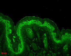Invitrogen ERK1 Polyclonal Antibody 100 &mu;L; Unconjugated:Antibodies,