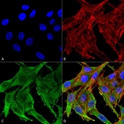 Invitrogen Kir4.1 (KCNJ10) Polyclonal Antibody 100 &mu;g; Unconjugated:Antibodies,