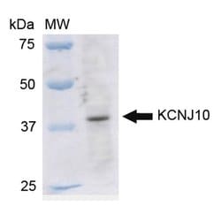 Invitrogen Kir4.1 (KCNJ10) Polyclonal Antibody 100 &mu;g; Unconjugated:Antibodies,