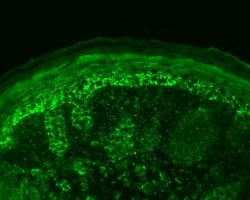 Invitrogen HSPE1 Polyclonal Antibody 100 &mu;g; Unconjugated:Antibodies,