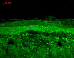 Invitrogen HSPB8 Polyclonal Antibody 100 &mu;L | Buy Online | Invitrogen&trade; | Fisher Scientific