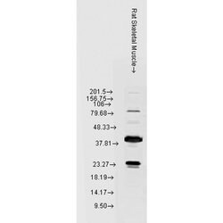 Invitrogen HSPB8 Polyclonal Antibody 100 &mu;L | Buy Online | Invitrogen&trade; | Fisher Scientific