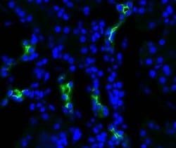 Invitrogen Aquaporin 2 Polyclonal Antibody 100 &mu;g; Unconjugated:Antibodies,