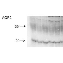 Invitrogen Aquaporin 2 Polyclonal Antibody 100 &mu;g; Unconjugated:Antibodies,