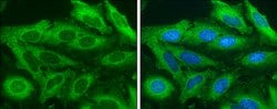 Invitrogen Acetyl-CoA Carboxylase Polyclonal Antibody 100 &mu;L; Unconjugated:Antibodies,