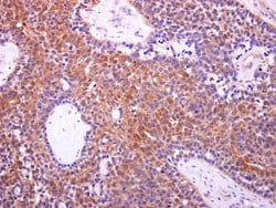 Invitrogen Aconitase 1 Polyclonal Antibody 100 &mu;L; Unconjugated:Antibodies,