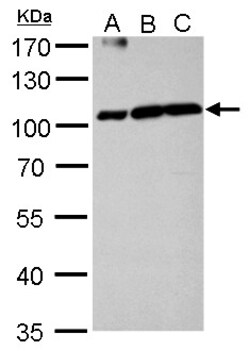 Invitrogen Aconitase 1 Polyclonal Antibody 100 &mu;L; Unconjugated:Antibodies,