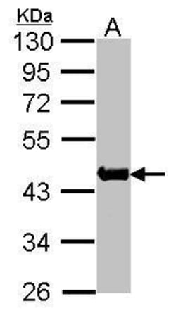 Invitrogen ACTA1 Polyclonal Antibody 100 &mu;L; Unconjugated:Antibodies