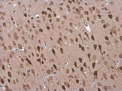Invitrogen ADORA2B Polyclonal Antibody 100 &mu;L; Unconjugated:Antibodies,