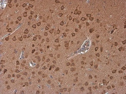 Invitrogen ADORA2B Polyclonal Antibody 100 &mu;L; Unconjugated:Antibodies,