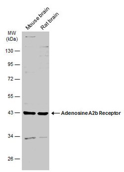Invitrogen ADORA2B Polyclonal Antibody 100 &mu;L; Unconjugated:Antibodies,