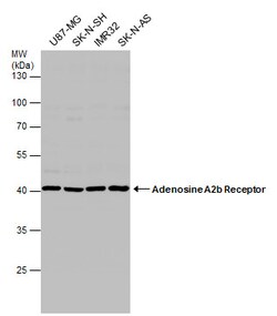 Invitrogen ADORA2B Polyclonal Antibody 100 &mu;L; Unconjugated:Antibodies,