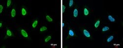 Invitrogen PARP1 (cleaved Asp214) Polyclonal Antibody 100 &mu;L; Unconjugated:Antibodies,