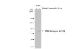 Invitrogen Phospho-GRK2 (Ser670) Polyclonal Antibody 100 &mu;L; Unconjugated:Antibodies,