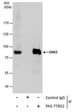 Invitrogen GRK2 Polyclonal Antibody 100 &mu;L | Buy Online | Invitrogen&trade; | Fisher Scientific