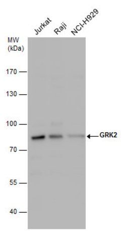 Invitrogen GRK2 Polyclonal Antibody 100 &mu;L | Buy Online | Invitrogen&trade; | Fisher Scientific