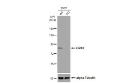 Invitrogen GRK2 Polyclonal Antibody 100 &mu;L | Buy Online | Invitrogen&trade; | Fisher Scientific