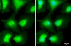 Invitrogen AKT Pan Polyclonal Antibody 100 &mu;L; Unconjugated:Antibodies,