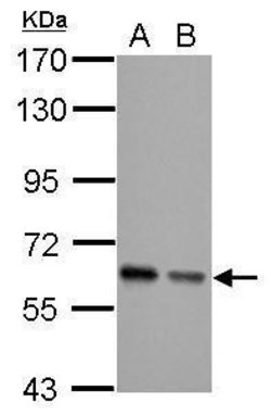 Invitrogen AKT Pan Polyclonal Antibody 100 &mu;L; Unconjugated:Antibodies,