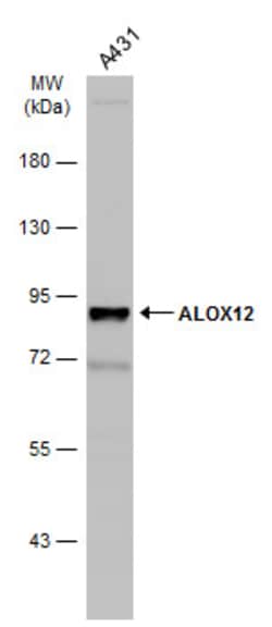 Invitrogen ALOX12 Polyclonal Antibody 100 &mu;L; Unconjugated:Antibodies,