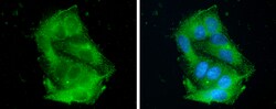 Invitrogen ApoC3 Polyclonal Antibody 100 &mu;L; Unconjugated:Antibodies,