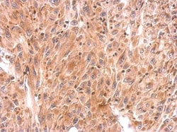 Invitrogen RhoB Polyclonal Antibody 100 &mu;L; Unconjugated:Antibodies,