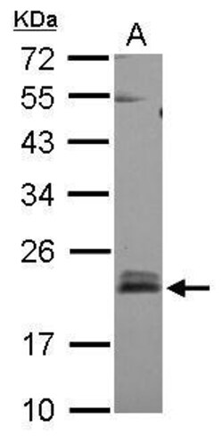 Invitrogen RhoB Polyclonal Antibody 100 &mu;L; Unconjugated:Antibodies,