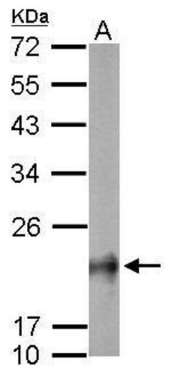 Invitrogen RhoB Polyclonal Antibody 100 &mu;L; Unconjugated:Antibodies,