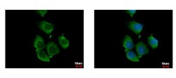 Invitrogen RhoC Polyclonal Antibody 100 &mu;L; Unconjugated:Antibodies,