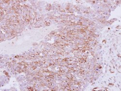 Invitrogen RhoC Polyclonal Antibody 100 &mu;L; Unconjugated:Antibodies,