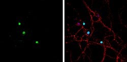 Invitrogen&trade;&nbsp;ASCL1 Polyclonal Antibody